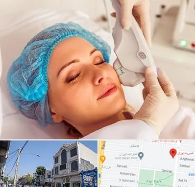 اکسنت در افسریه 