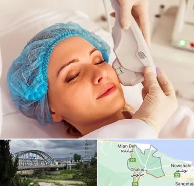 اکسنت در چالوس