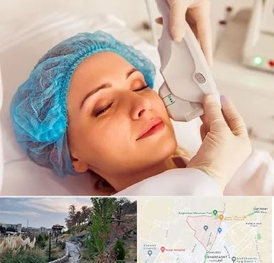 اکسنت در باغستان کرج