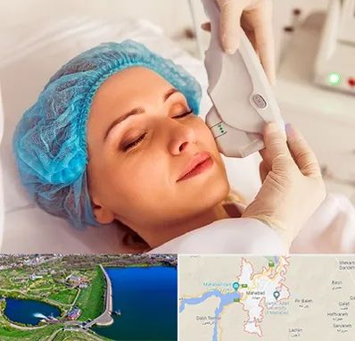 اکسنت در مهاباد