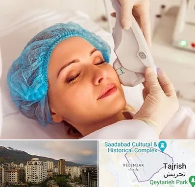 اکسنت در زعفرانیه 