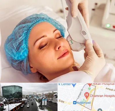 اکسنت در اقدسیه 