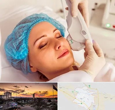 اکسنت در قوچان