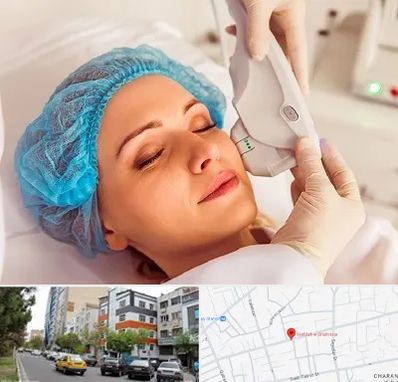 اکسنت در هفده شهریور تبریز