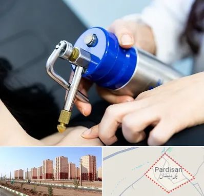 کرایوتراپی در پردیسان قم