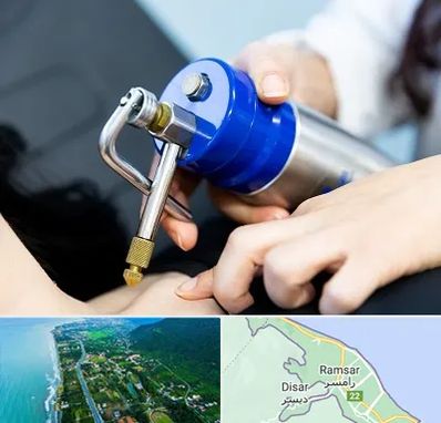 کرایوتراپی در رامسر