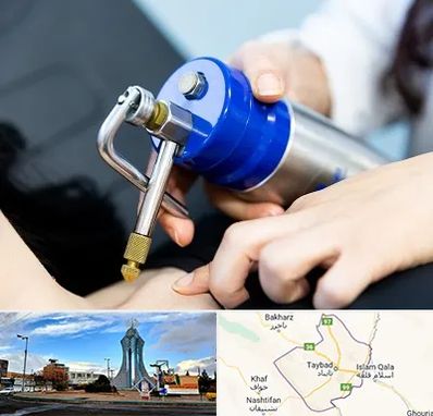 کرایوتراپی در تایباد