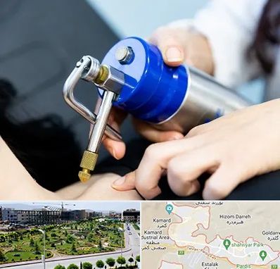 کرایوتراپی در پردیس