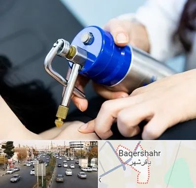 کرایوتراپی در باقرشهر