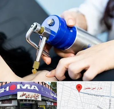 کرایوتراپی در امین حضور