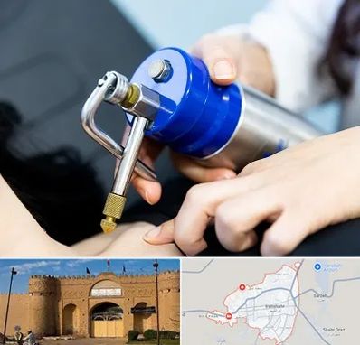 کرایوتراپی در ایرانشهر