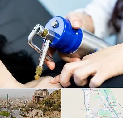 کرایوتراپی در فرهنگ شهر شیراز