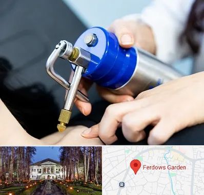 کرایوتراپی در باغ فردوس