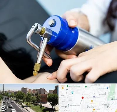 کرایوتراپی در شهرک آزمایش 