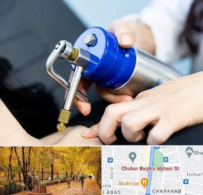 کرایوتراپی در چهارباغ اصفهان