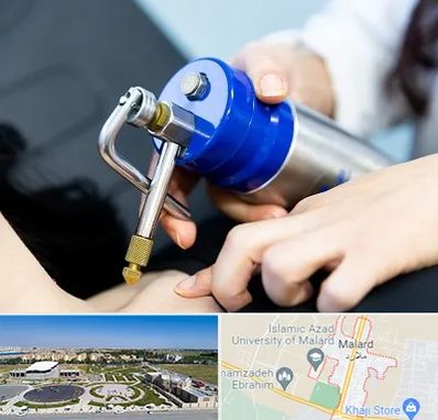 کرایوتراپی در ملارد