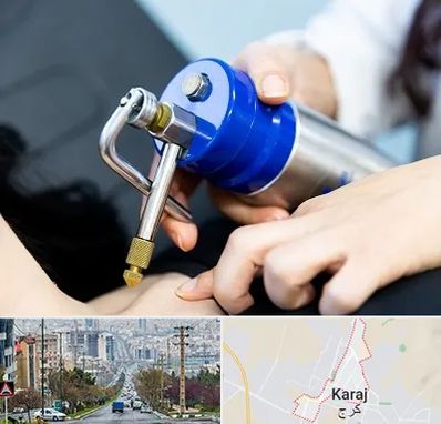 کرایوتراپی در گوهردشت کرج 