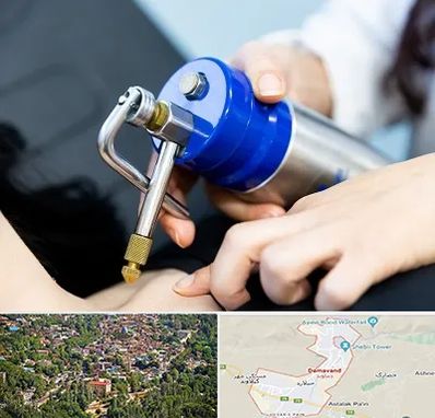 کرایوتراپی در دماوند