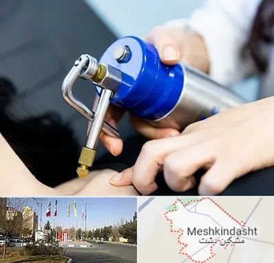 کرایوتراپی در مشکین دشت