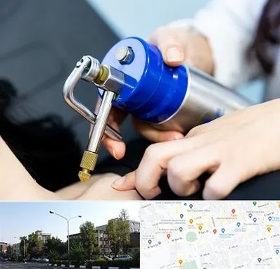 کرایوتراپی در میدان کاج 