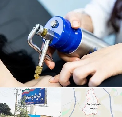 کرایوتراپی در فردوسیه شهریار