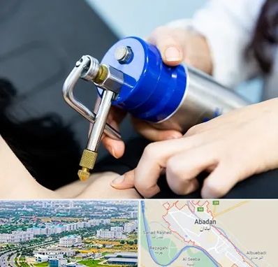 کرایوتراپی در آبادان