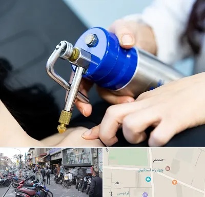 کرایوتراپی در چهارراه استانبول
