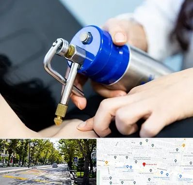 کرایوتراپی در میرداماد 