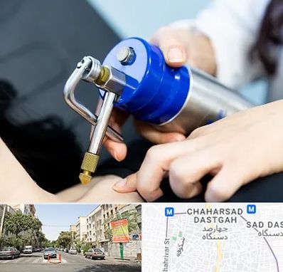 کرایوتراپی در چهارصد دستگاه 