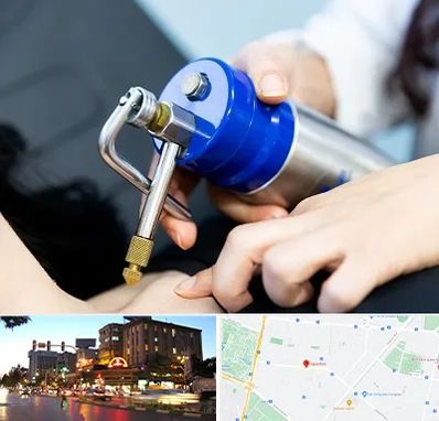 کرایوتراپی در بلوار سجاد مشهد 