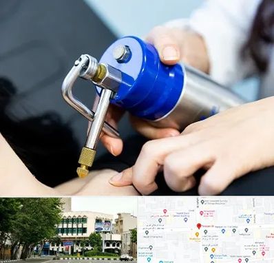 کرایوتراپی در طالقانی 