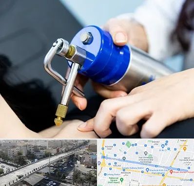 کرایوتراپی در فرجام