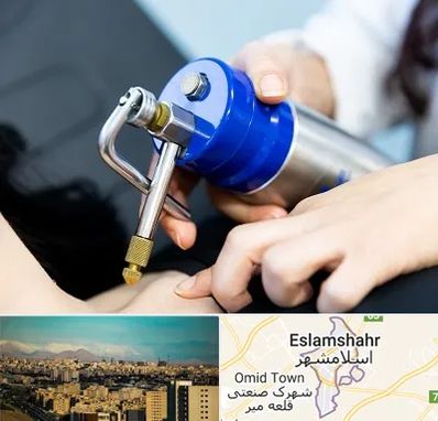 کرایوتراپی در اسلامشهر