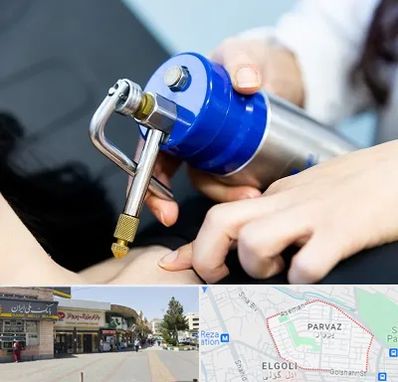 کرایوتراپی در پرواز تبریز