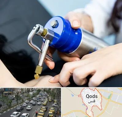 کرایوتراپی در شهر قدس