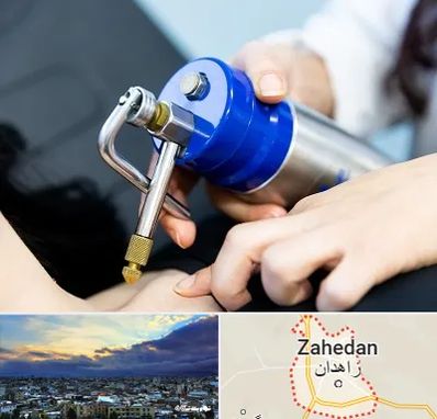 کرایوتراپی در زاهدان