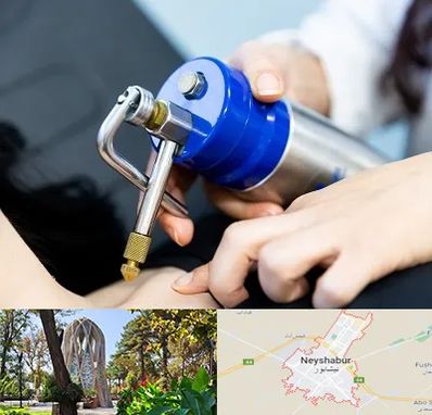 کرایوتراپی در نیشابور