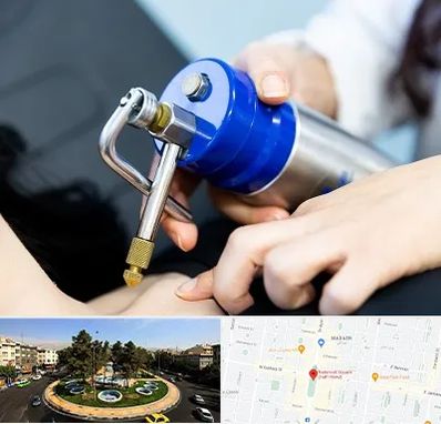 کرایوتراپی در هفت حوض 