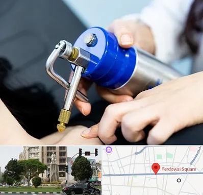 کرایوتراپی در میدان فردوسی تهران
