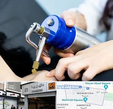 کرایوتراپی در منیریه 