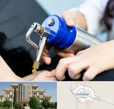 کرایوتراپی در دهدشت