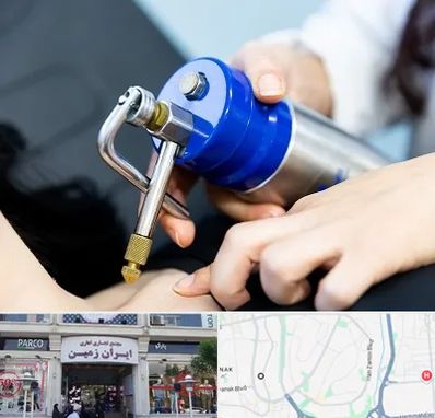 کرایوتراپی در ایران زمین