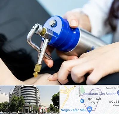 کرایوتراپی در قلهک 