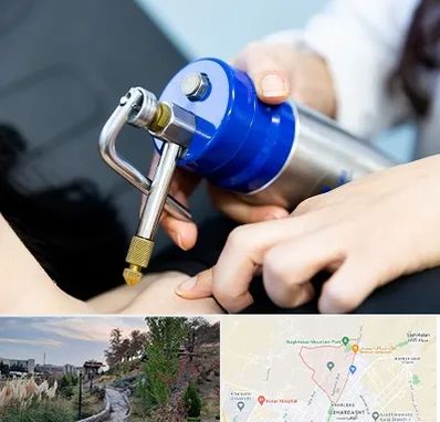 کرایوتراپی در باغستان کرج