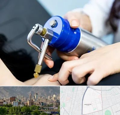 کرایوتراپی در جمشیدیه