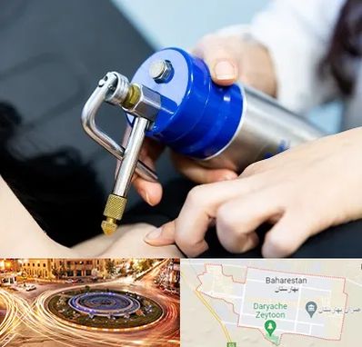 کرایوتراپی در بهارستان