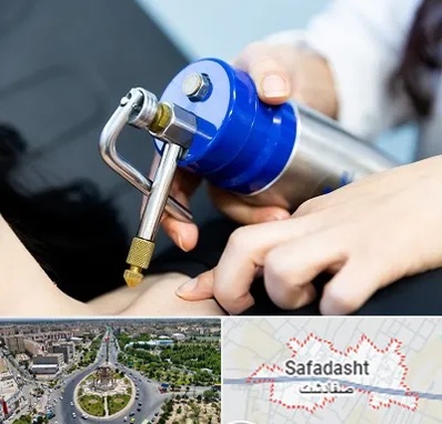 کرایوتراپی در صفادشت