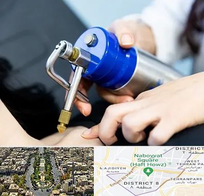 کرایوتراپی در نارمک 