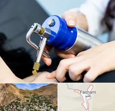 کرایوتراپی در فشم