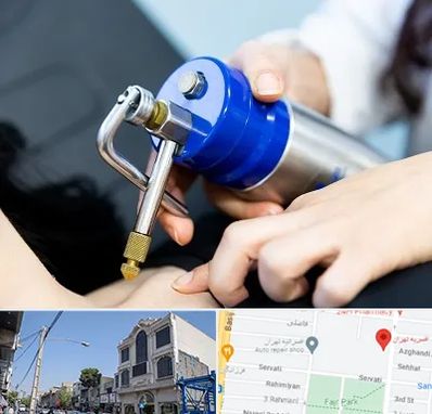 کرایوتراپی در افسریه 